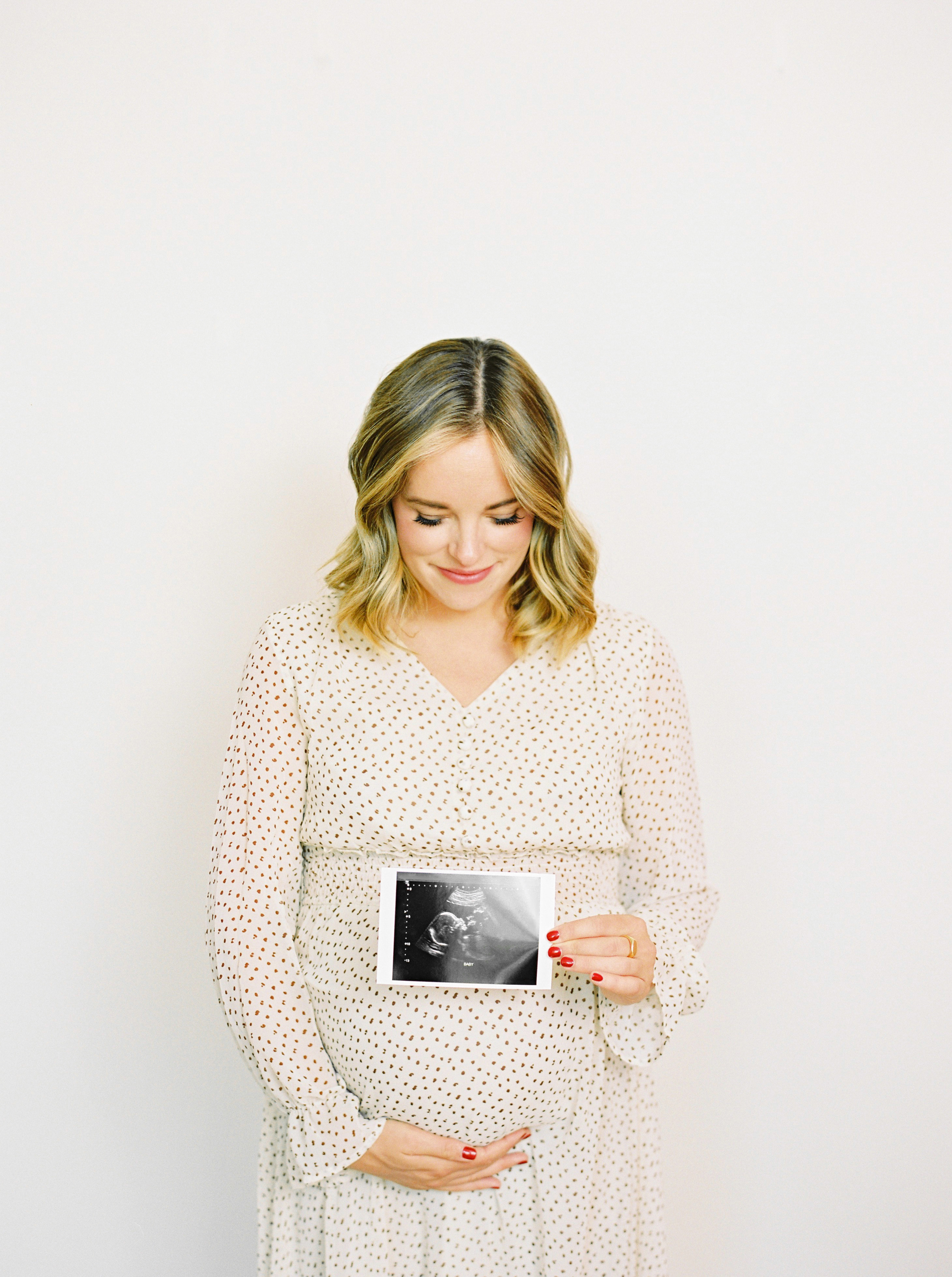 Pregnant white blond woman dressing in white dress holding baby bump and scan photo